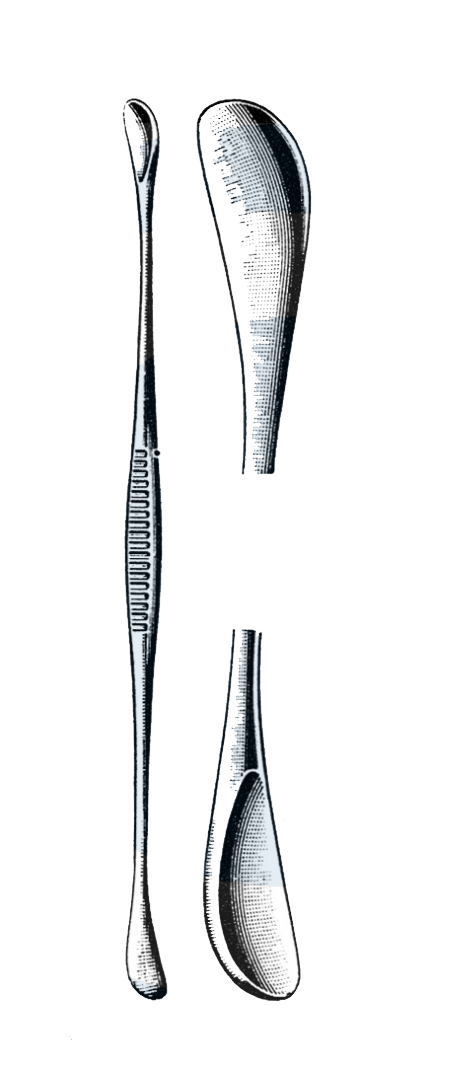 Furguson Gall Stone Scoop, Small 9 1/4" (23.5 cm) - Garana Industries